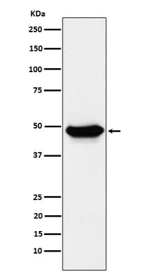Anti-ENTPD5 Rabbit Monoclonal Antibody Boster Bio