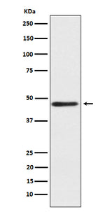 Anti-ENTPD5 Rabbit Monoclonal Antibody Boster Bio