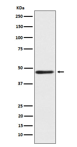 Anti-ENTPD5 Rabbit Monoclonal Antibody Boster Bio
