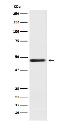 Anti-ENTPD5 Rabbit Monoclonal Antibody Boster Bio