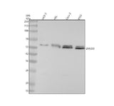 Anti-ZNF259 Rabbit Monoclonal Antibody Boster Bio