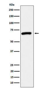 Anti-USP39 Rabbit Monoclonal Antibody Boster Bio