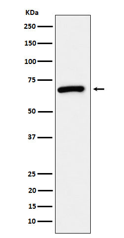 Anti-USP39 Rabbit Monoclonal Antibody Boster Bio