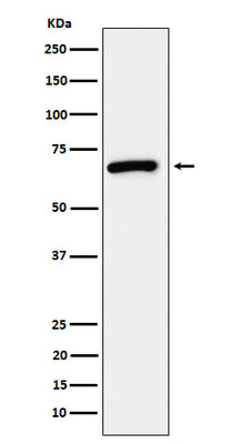Anti-USP39 Rabbit Monoclonal Antibody Boster Bio