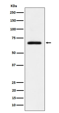Anti-USP39 Rabbit Monoclonal Antibody Boster Bio