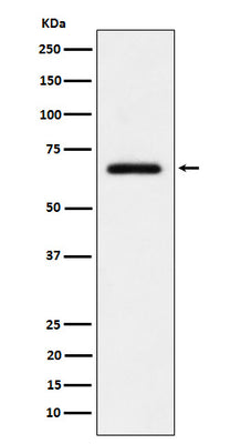 Anti-USP39 Rabbit Monoclonal Antibody Boster Bio