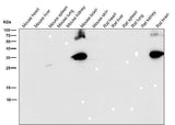 Anti-Syntaxin Rabbit Monoclonal Antibody Boster Bio