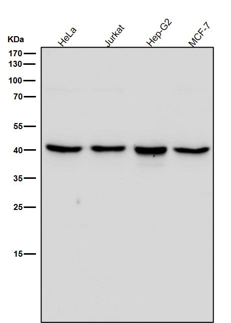 Anti-ALKBH1 Rabbit Monoclonal Antibody Boster Bio