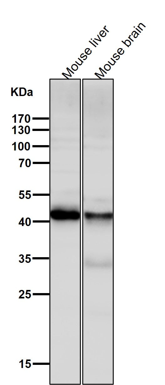 Anti-ALKBH1 Rabbit Monoclonal Antibody Boster Bio