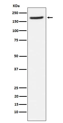 Anti-Aminopeptidase A / CD249 Rabbit Monoclonal Antibody Boster Bio