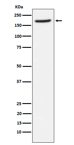 Anti-Aminopeptidase A / CD249 Rabbit Monoclonal Antibody Boster Bio
