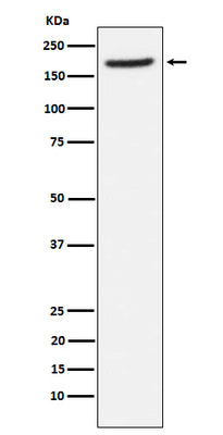 Anti-Aminopeptidase A / CD249 Rabbit Monoclonal Antibody Boster Bio