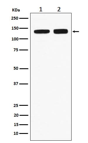 Anti-RNF40 Rabbit Monoclonal Antibody Boster Bio