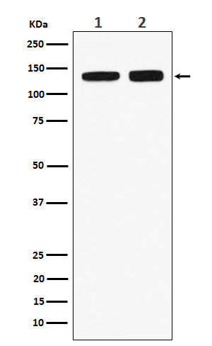 Anti-RNF40 Rabbit Monoclonal Antibody Boster Bio