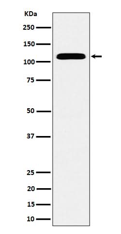 Anti-SEC24D Rabbit Monoclonal Antibody Boster Bio