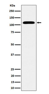 Anti-SEC24D Rabbit Monoclonal Antibody Boster Bio