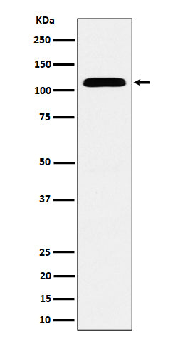Anti-SEC24D Rabbit Monoclonal Antibody Boster Bio