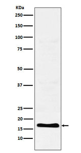 Anti-TFF2 Rabbit Monoclonal Antibody Boster Bio