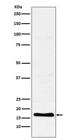 Anti-TFF2 Rabbit Monoclonal Antibody Boster Bio
