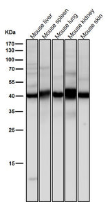 Anti-Erlin-2 Rabbit Monoclonal Antibody Boster Bio