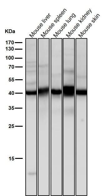 Anti-Erlin-2 Rabbit Monoclonal Antibody Boster Bio