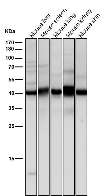 Anti-Erlin-2 Rabbit Monoclonal Antibody Boster Bio