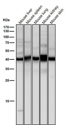 Anti-Erlin-2 Rabbit Monoclonal Antibody Boster Bio
