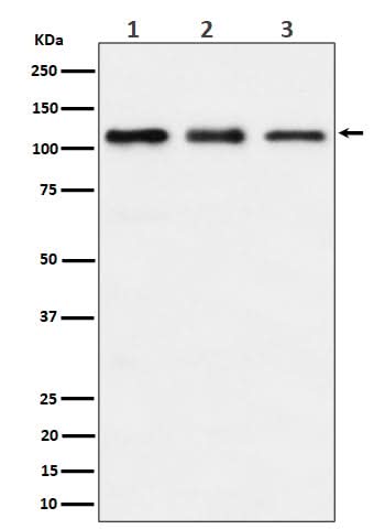 Anti-TAOK1 Rabbit Monoclonal Antibody Boster Bio