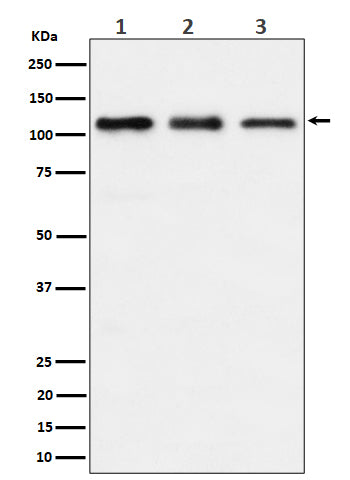 Anti-TAOK1 Rabbit Monoclonal Antibody Boster Bio