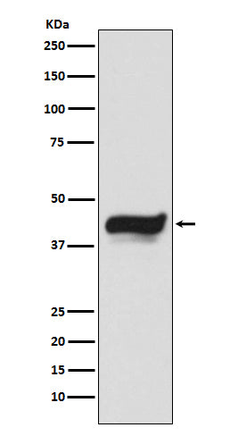 Anti-IKB epsilon NFKBIE Monoclonal Antibody Boster Bio