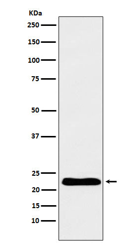 Anti-TNNI1 Rabbit Monoclonal Antibody Boster Bio