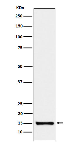 Anti-SAA4 Rabbit Monoclonal Antibody Boster Bio