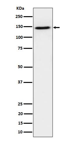 Anti-TAF3 Rabbit Monoclonal Antibody Boster Bio