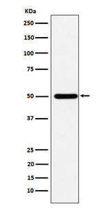 Anti-ABAT Rabbit Monoclonal Antibody Boster Bio