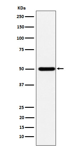 Anti-ABAT Rabbit Monoclonal Antibody Boster Bio