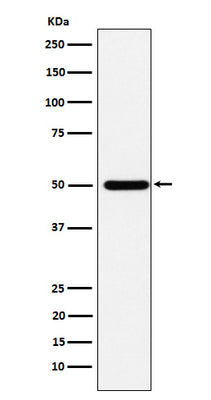 Anti-ABAT Rabbit Monoclonal Antibody Boster Bio