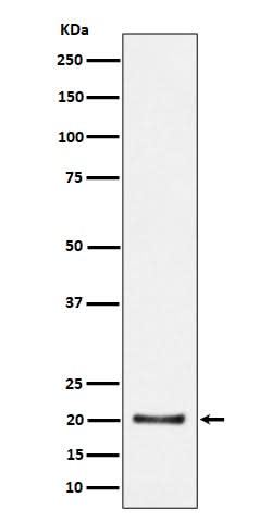 Anti-CSN8 Rabbit Monoclonal Antibody Boster Bio
