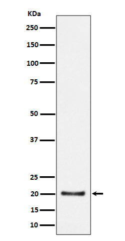 Anti-CSN8 Rabbit Monoclonal Antibody Boster Bio