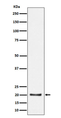 Anti-CSN8 Rabbit Monoclonal Antibody Boster Bio