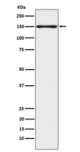 Anti-CLSTN1 Rabbit Monoclonal Antibody Boster Bio