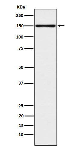 Anti-CLSTN1 Rabbit Monoclonal Antibody Boster Bio