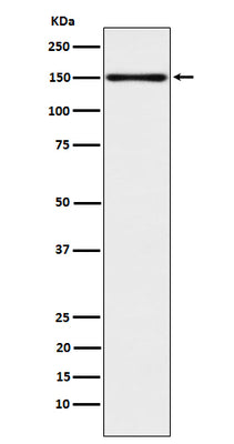 Anti-CLSTN1 Rabbit Monoclonal Antibody Boster Bio