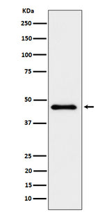 Anti-ELP4 Rabbit Monoclonal Antibody Boster Bio