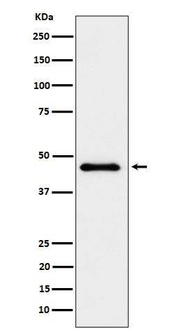 Anti-ELP4 Rabbit Monoclonal Antibody Boster Bio