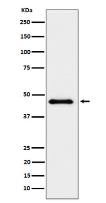 Anti-ELP4 Rabbit Monoclonal Antibody Boster Bio