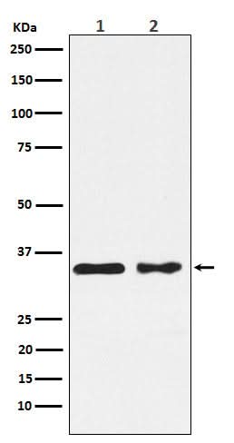Anti-CSNK1A1 Rabbit Monoclonal Antibody Boster Bio