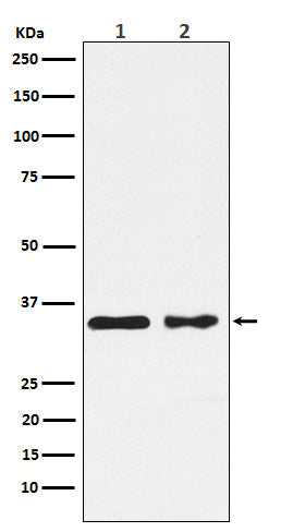 Anti-CSNK1A1 Rabbit Monoclonal Antibody Boster Bio