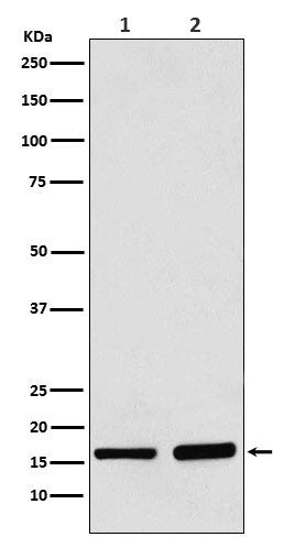 Anti-AP2S1 Rabbit Monoclonal Antibody Boster Bio