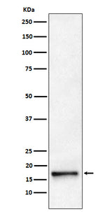 Anti-AP2S1 Rabbit Monoclonal Antibody Boster Bio