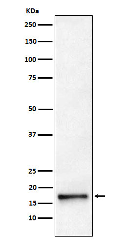 Anti-AP2S1 Rabbit Monoclonal Antibody Boster Bio
